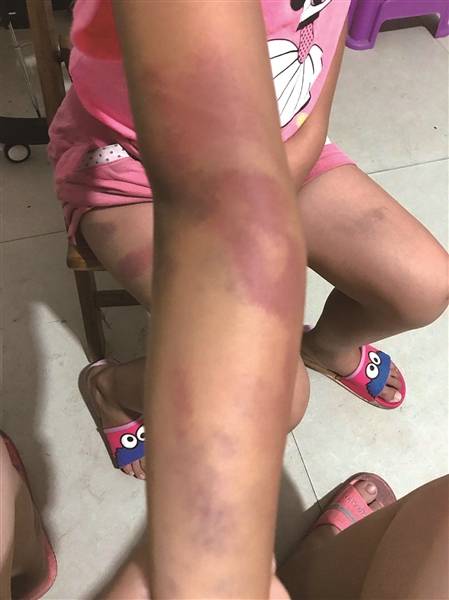 女孩打暑假工被拍屁股，警方介入，这事没那么简单